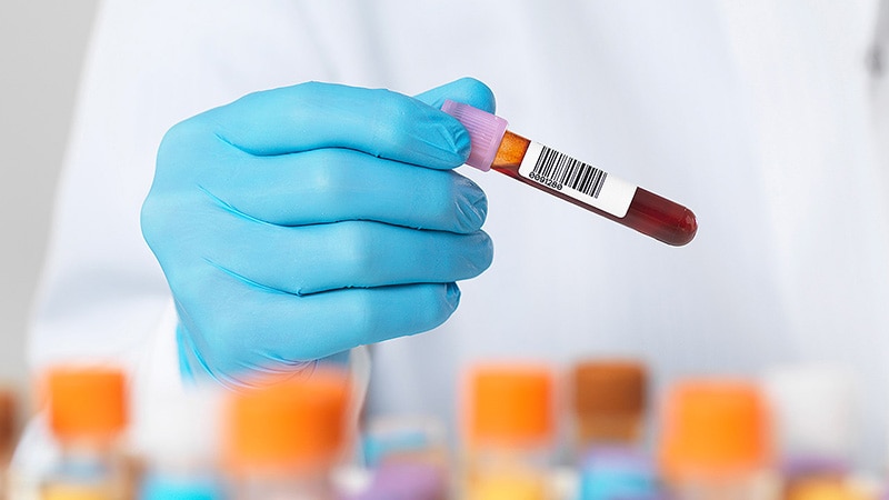 Tau Blood Test Flags Preclinical Alzheimer's Disease
