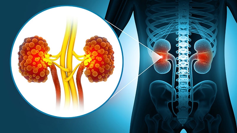 Semaglutide Reduces MACE, Death in Impaired Kidney Function