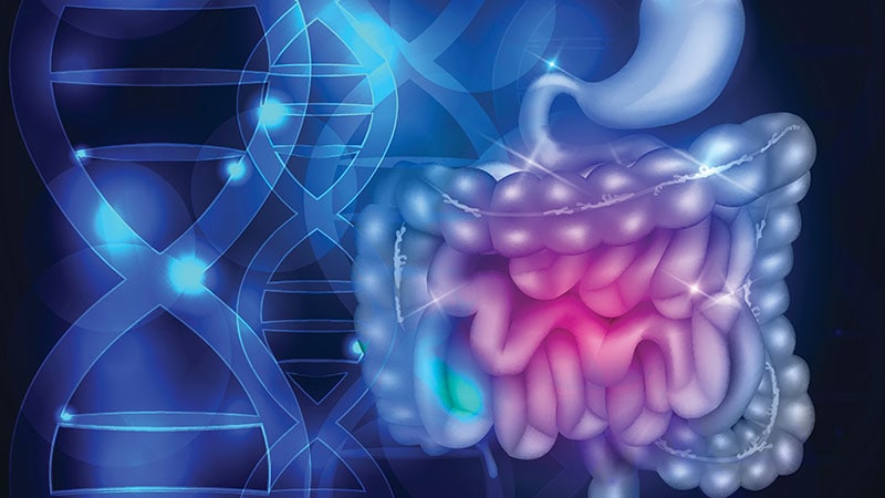 Genetic Marker Tied to Severe Ulcerative Colitis Identified