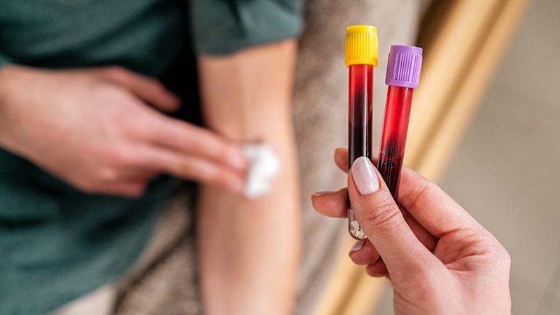At-Home Alzheimer's Testing Is Here: Are Physicians Ready?