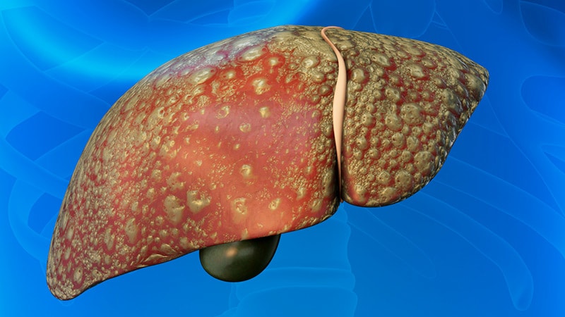 ‘Watershed Moment’: Semaglutide Effective in MASH