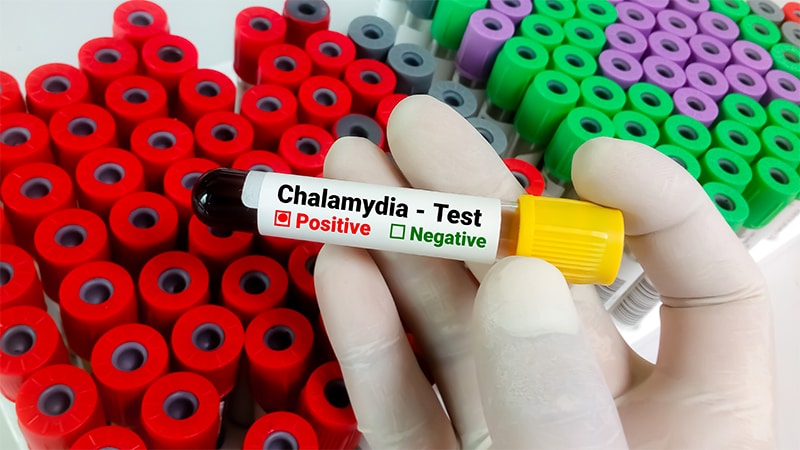 Doxycycline Kits Improve Chlamydia Treatment in Emergency Departments