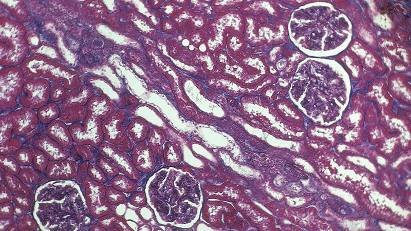 Immunosuppressive Therapies in C3 Glomerulopathy