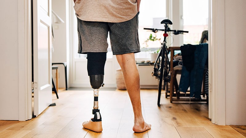 Health Insurers Limit Coverage of Prosthetic Limbs