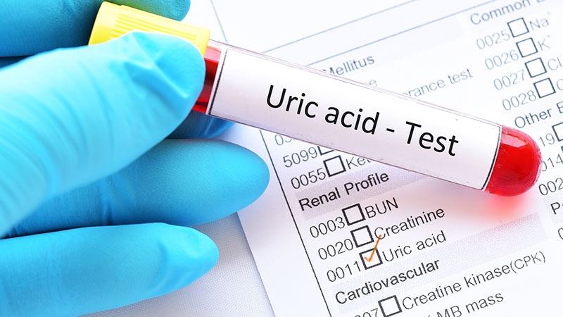 Serum Uric Acid Levels Predict NAFLD Risk in Nonobese Adults