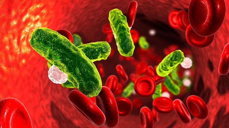 Early Vasopressin for Septic Shock: A Debate on Its Merits