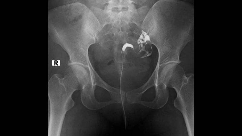 Risky Self-Love: Unusual Cases From the Emergency Room