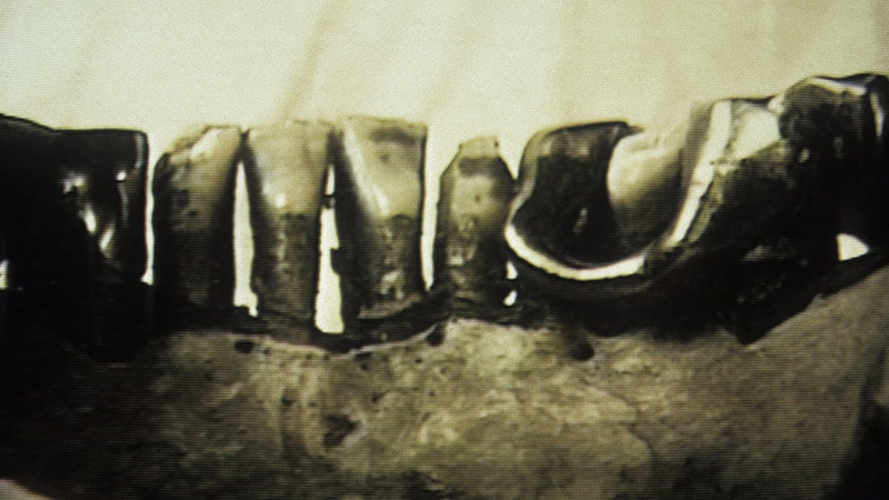 Behind History’s Icons II: Hitler’s Jaw and Cold War Secrets