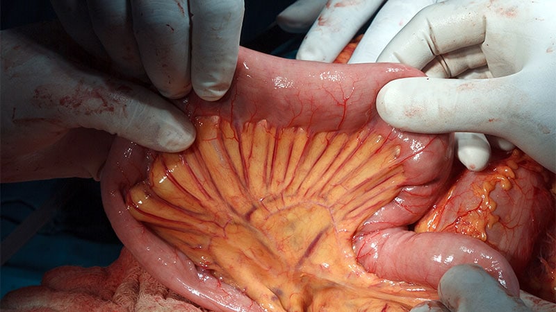 Sclerosing Mesenteritis: Update on Rare GI Disease