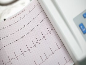 photo of Cardiography