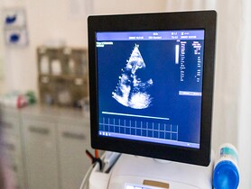photo of Ultrasound echocardiogram