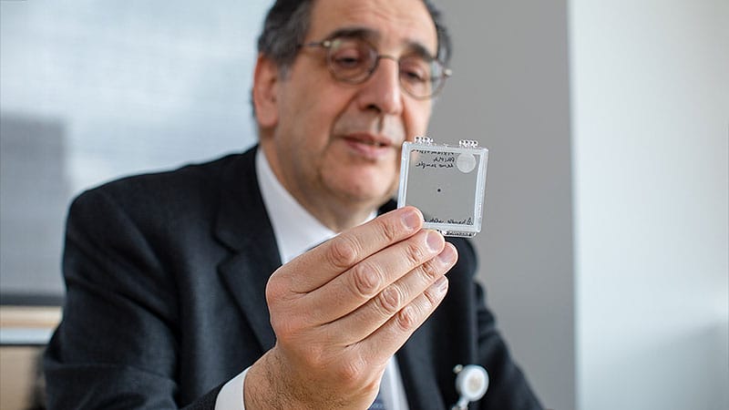 Subretinal Implant Improves Vision in Advanced Dry AMD