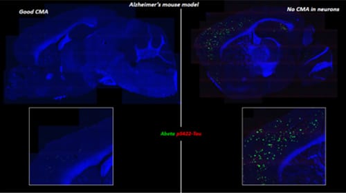 photo of A mouse brain with intact CMA (left) shows little amyloid-beta and phosphorylated tau, while one with no CMA (right)