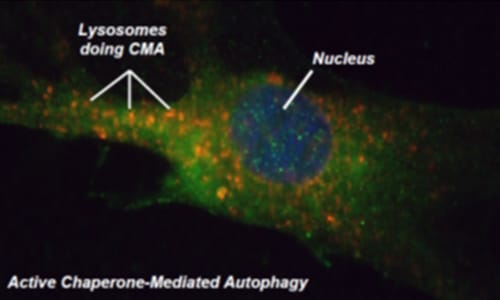 photo of In a healthy cell with active chaperone-mediated autophagy (CMA), lysosomes -- represented by the bright fluorescent