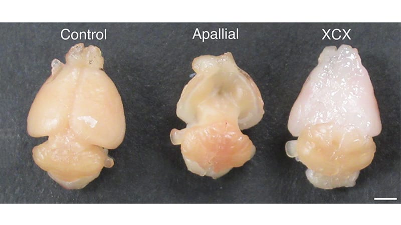 Brain Organoid Transplants and Cracking the Autism Code