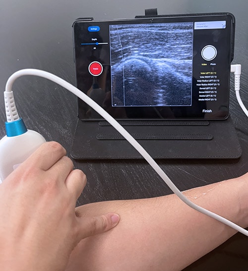 photo of Hareendranathan&#039;s portable ultrasound in action