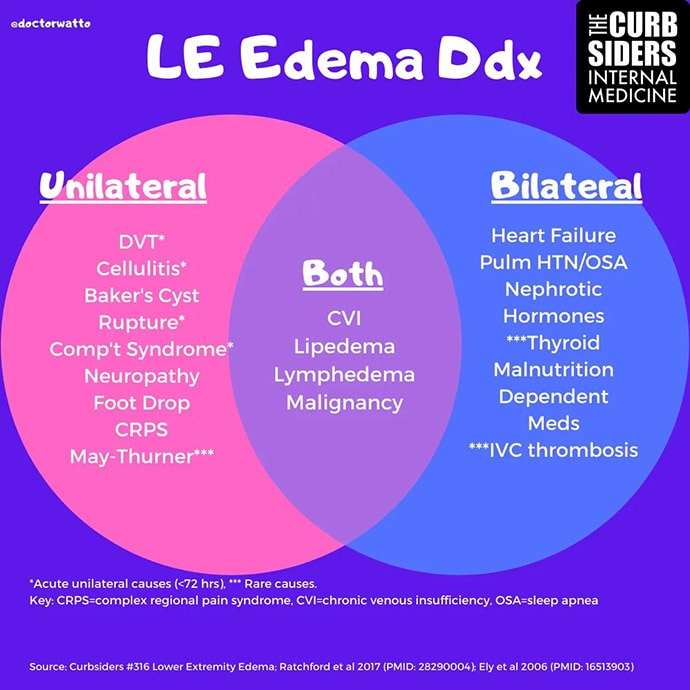 The Experts on Lower Extremity Edema? Primary Care