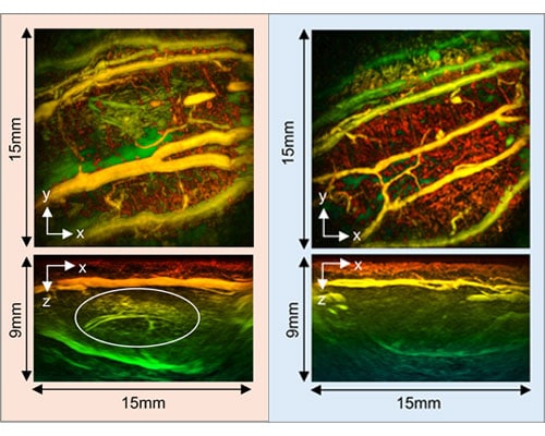 photo of Arthritis_diseased and arthritis_healthy