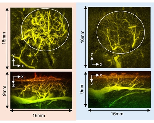 photo of Skin_inflamed and Skin_subsided