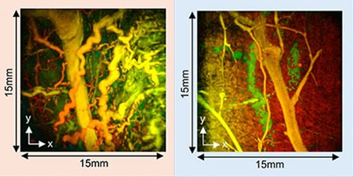 photo of VAS_diseased and VAS_healthy