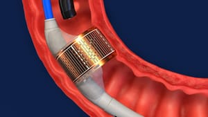 oxycodone and semaglutide A U.S. study involving 503,747 patients with a history of opioid disorder  and 817,309 patients with a history of alcohol use disorder found that  those prescribed Ozempic and related weight loss drugs