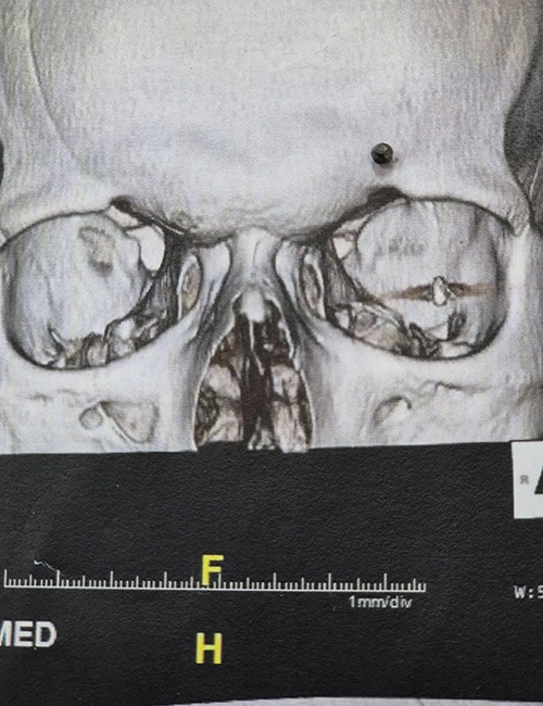 photo of Minhaj's bullet