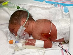 photo of He's a tough little guy
