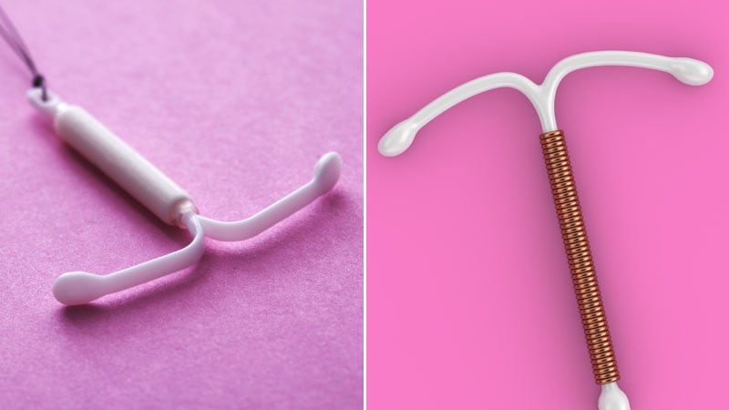 Copper IUDs Linked to Higher Risk for STI Than Hormonal IUDs