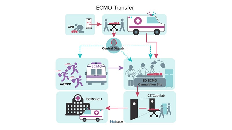 Will ECPR Move the Needle on Cardiac Arrest Survival? thumbnail