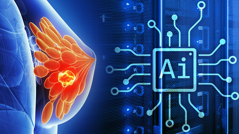 Can AI Tool Guide CDK4/6 Inhibitor Use in Breast Cancer?