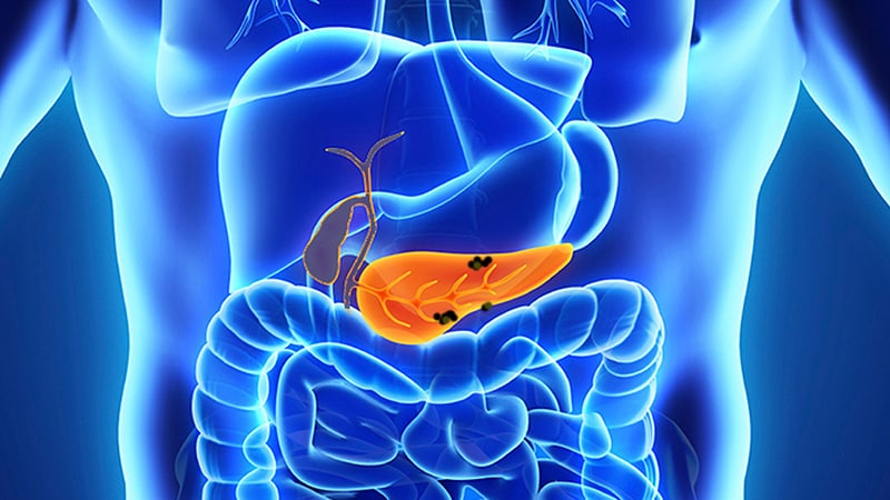 AI-Assisted EUS for Pancreatic Lesions