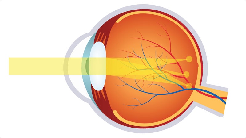 Eye Toxicities Are a Rising Concern With Sure ADCs