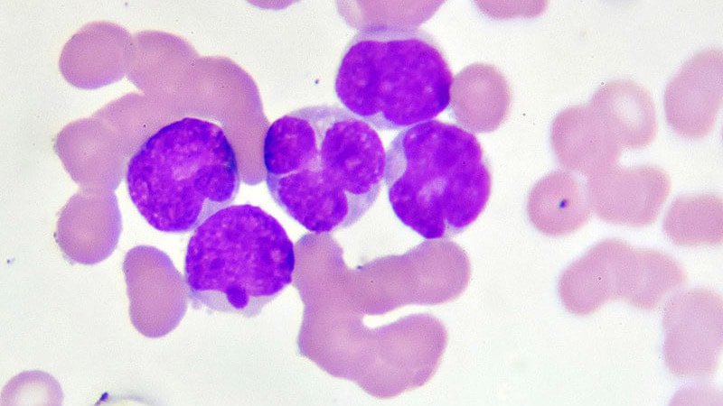 Can Nivolumab Maintain AML Remission?