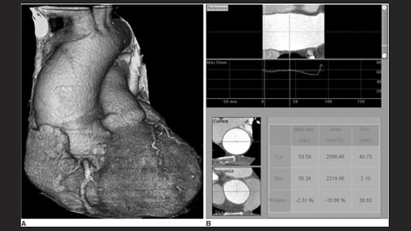 Is There a Link Between Elevated BAA & All-Cause Mortality?