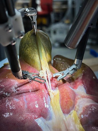 photo of Unassisted robotic surgery on a porcine gallbladder.