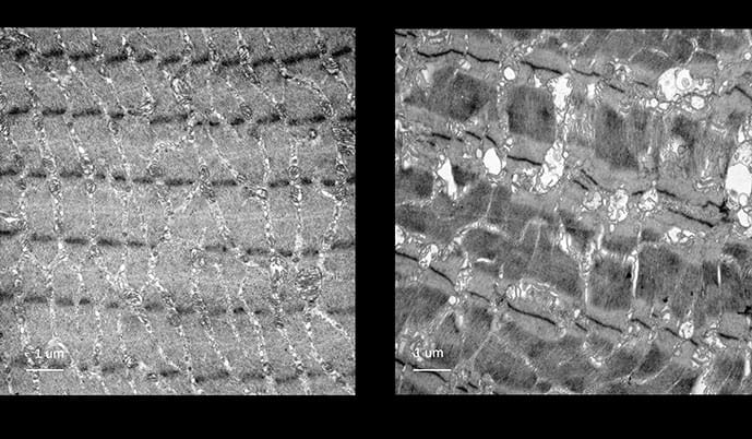 photo of Electron microscopy images of sarcomeres