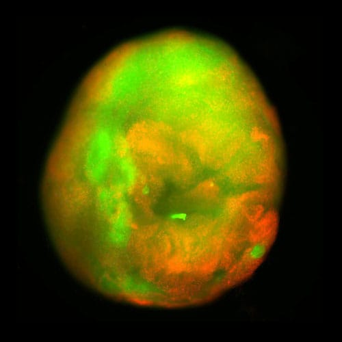 photo of Contusion from a mechanical impactor