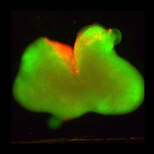 photo of Cell death (red) concentrates at the laceration site while healthy neurons (green) survive in surrounding tissue.
