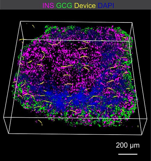 photo of Immunostained organoid showing insulin-producing beta cells (magenta), glucagon-producing alpha cells (green), and t
