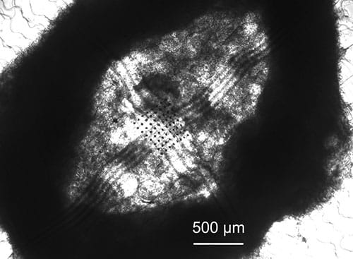 photo of A cyborg pancreatic organoid after self-assembly. The dark grid visible at the center is the mesh electronics embedd