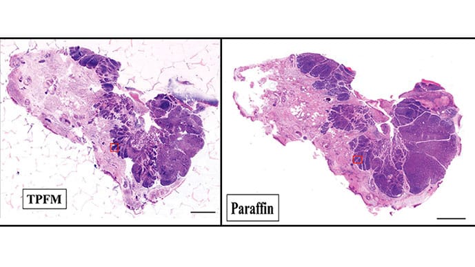photo of Two-photon fluorescence microscopy (TPFM) and standard histology image