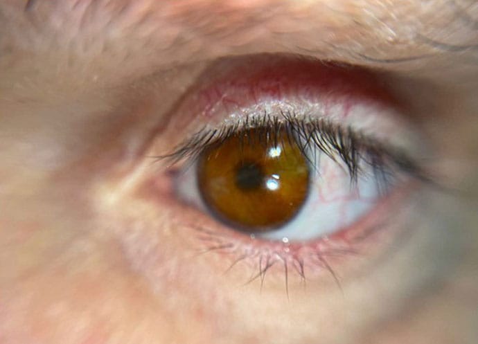 photo of a 3D eye