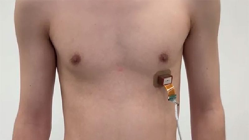 New Wearable Ultrasound Pacemaker Works Outside the Body