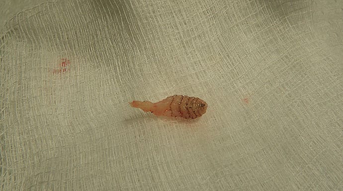 photo of insect bites