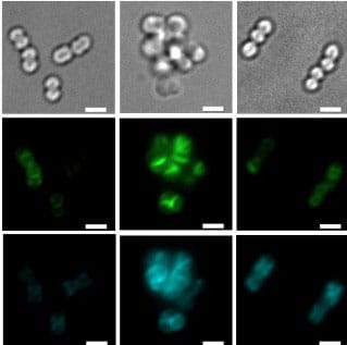 photo of Fluorescence microscopy of VREfm strains