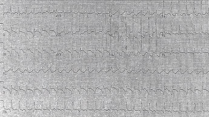 photo of an ECG