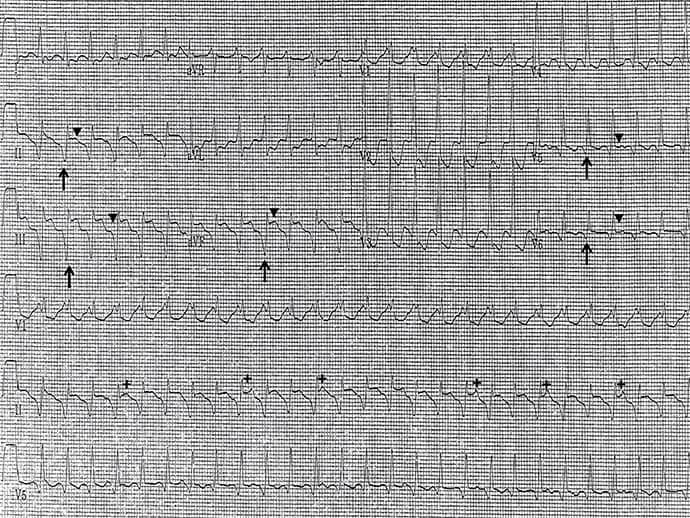 photo of an ECG