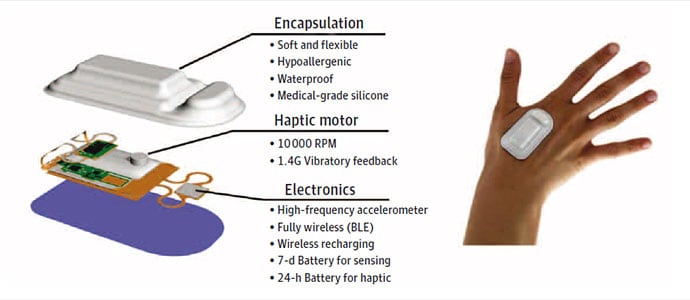 photo of AI-enabled wearable device evaluated in the study