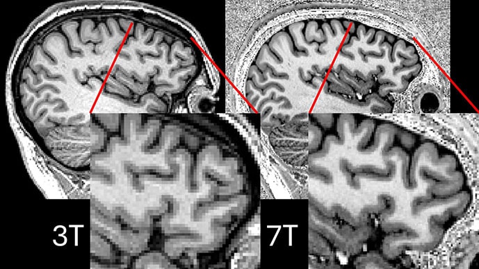 photo of Comparison showing 3T and 7T scans
