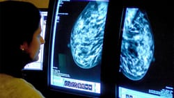 Breast Cancer Cells 'Hibernate' to Evade Treatment
